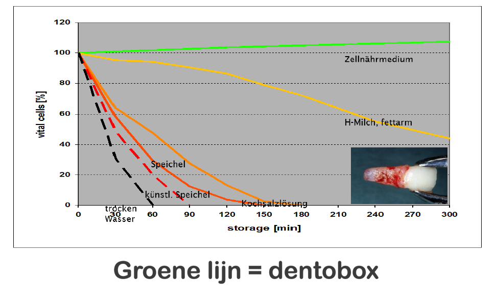 tand afgebroken uitgevallen kies