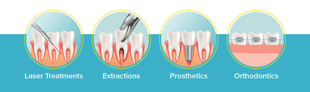 mondhygienist tandsteen verwijderen