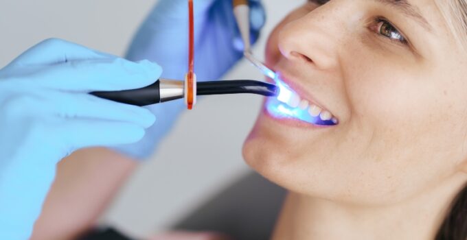 Lasers in de tandheelkunde